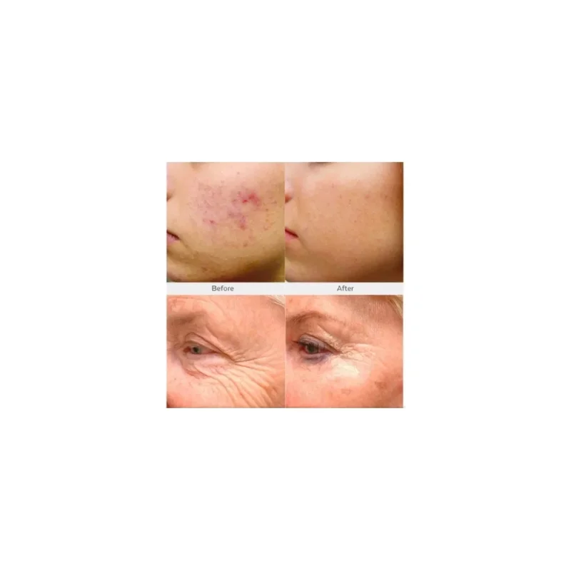 ibspot-5135318