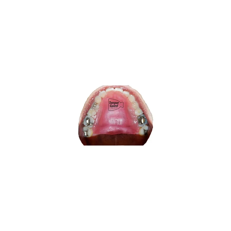 ibspot5565273